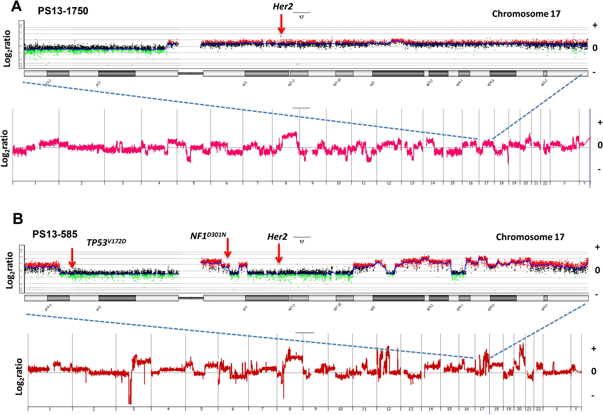 Unique evolutionary trajectories of breast cancers with distinct genomic and spatial heterogeneity